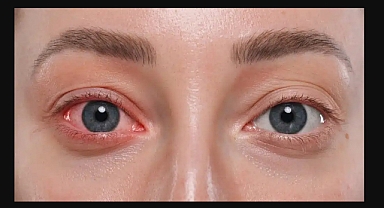 Sosyal medya önerileri göz sağlığını tehdit ediyor 