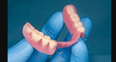 Protez dişlerin ömrünü uzatmak mümkün