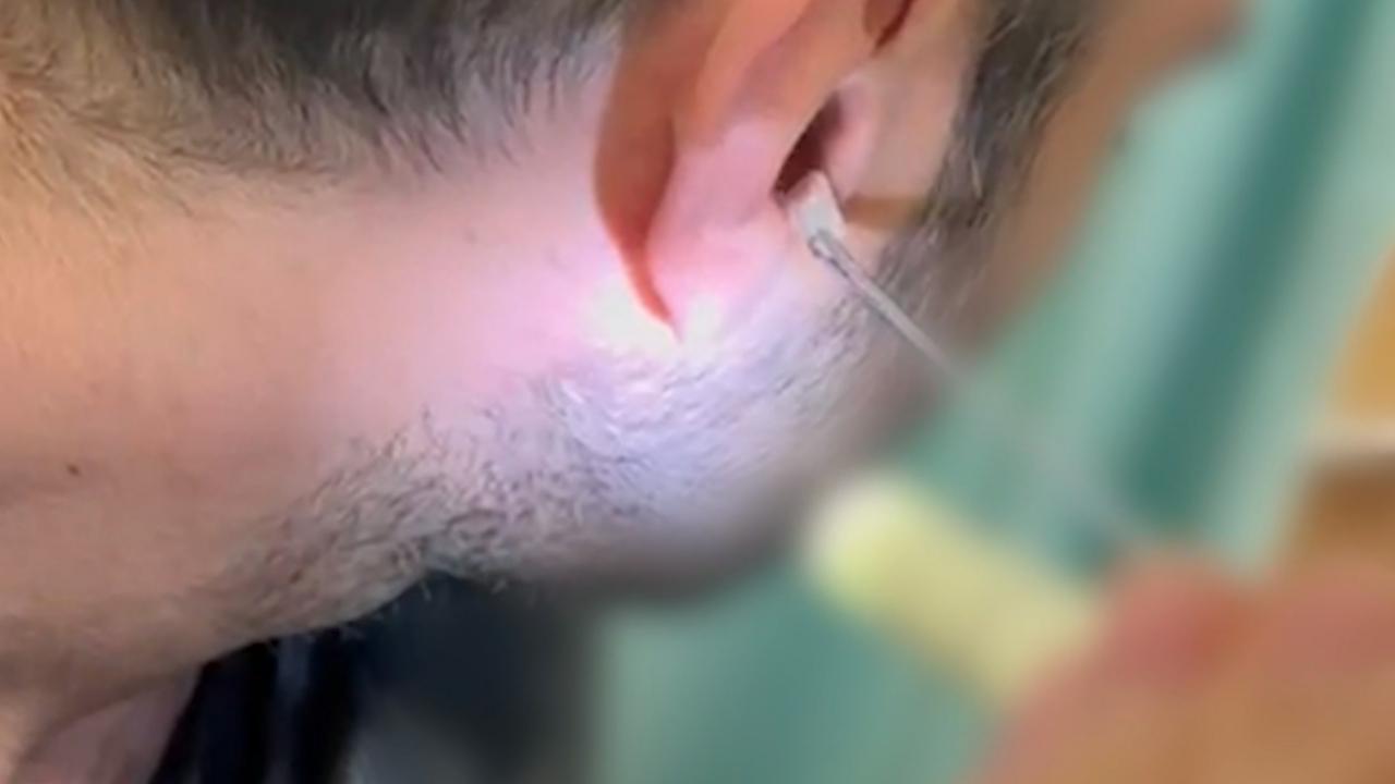 Kulağının içine uyuşturucu madde saklayan zanlı yakalandı