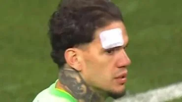 Ederson'a yabancı madde atılmasıyla ilgili 10 taraftara işlem